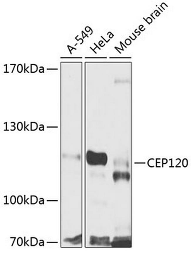 CEP120 Antibody in Western Blot (WB)