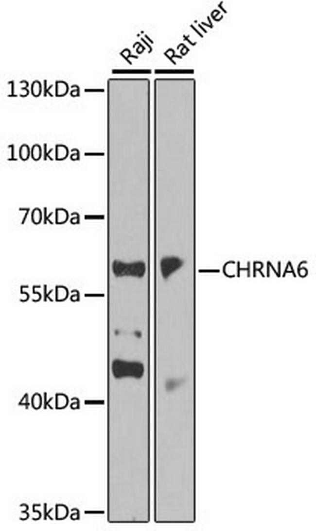 CHRNA6 Antibody in Western Blot (WB)