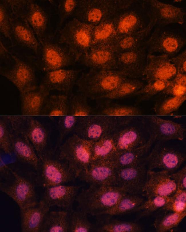 CHTF18 Antibody in Immunocytochemistry (ICC/IF)