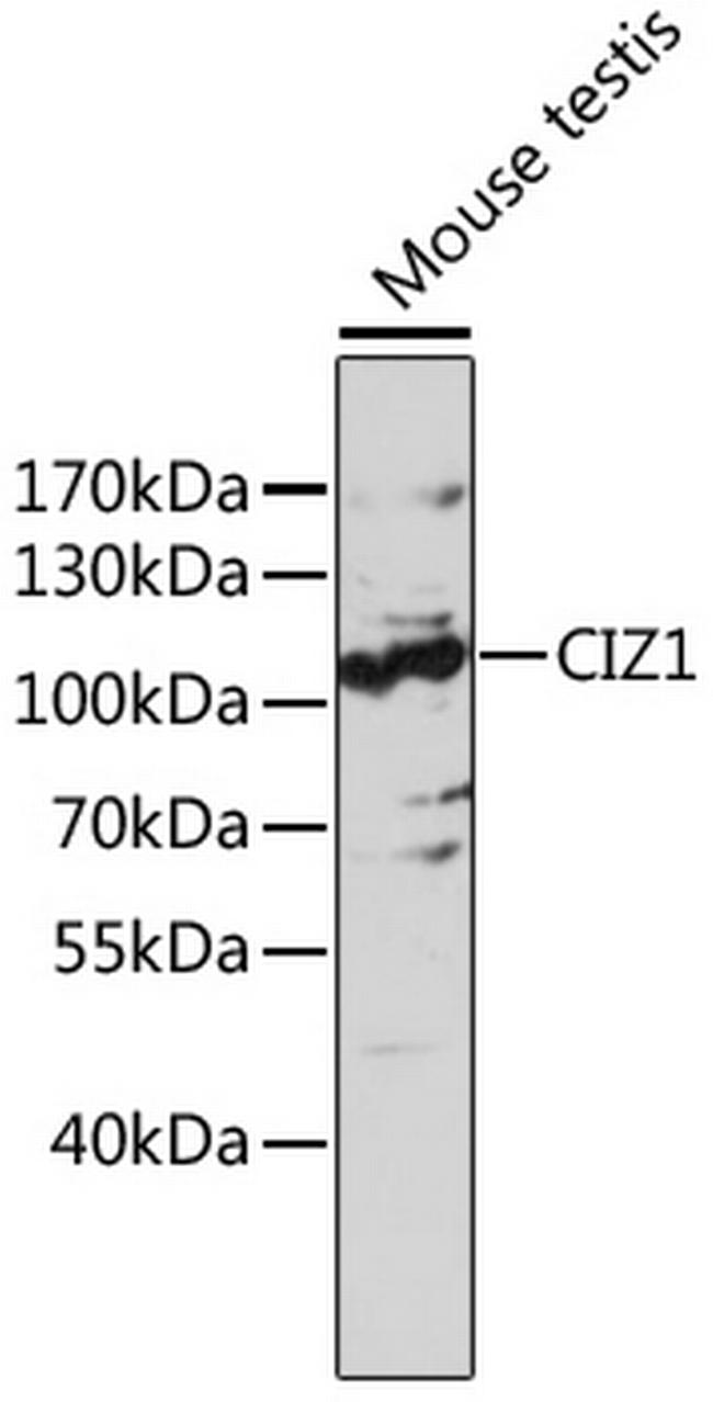 CIZ1 Antibody in Western Blot (WB)