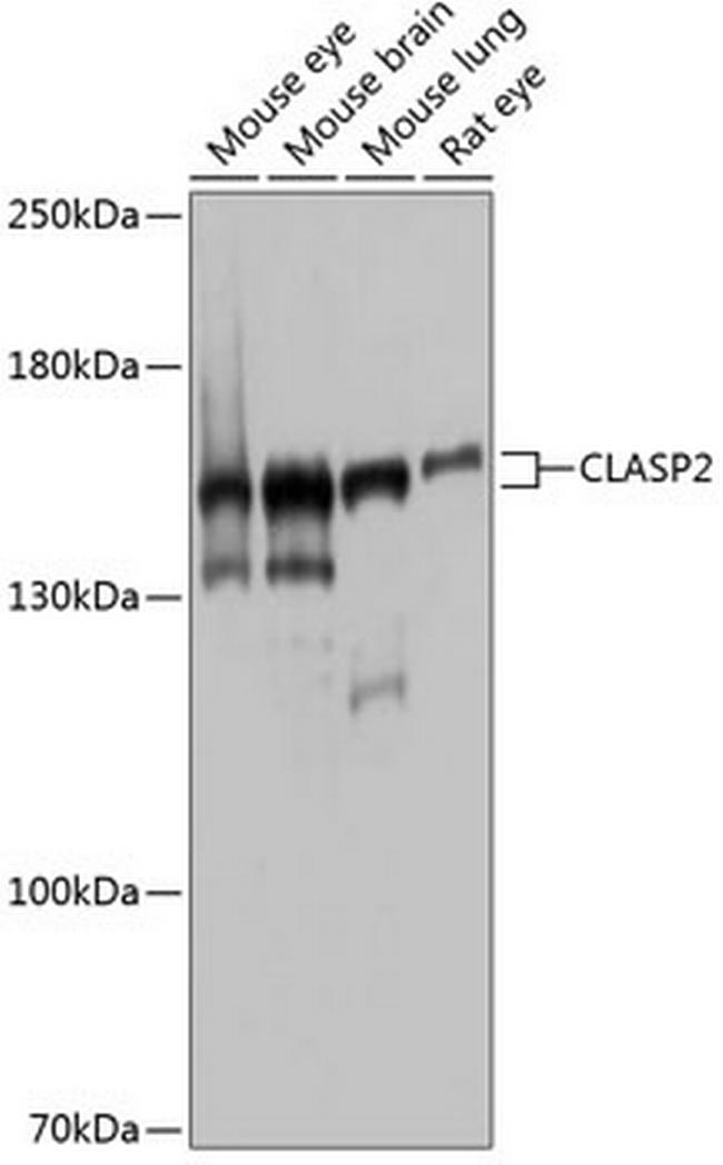 CLASP2 Antibody in Western Blot (WB)