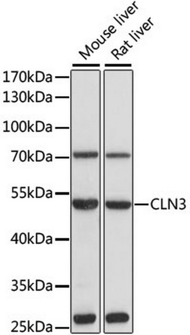 CLN3 Antibody in Western Blot (WB)