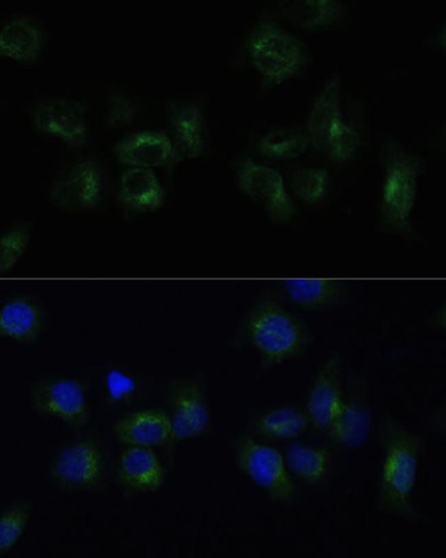 CLTB Antibody in Immunocytochemistry (ICC/IF)