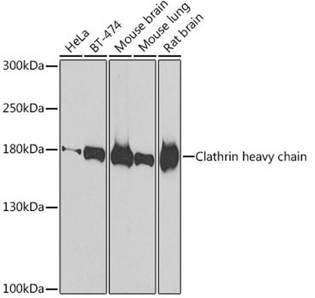 CLTC Antibody in Western Blot (WB)