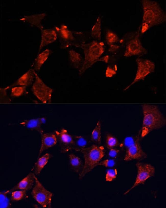 CLUH Antibody in Immunocytochemistry (ICC/IF)