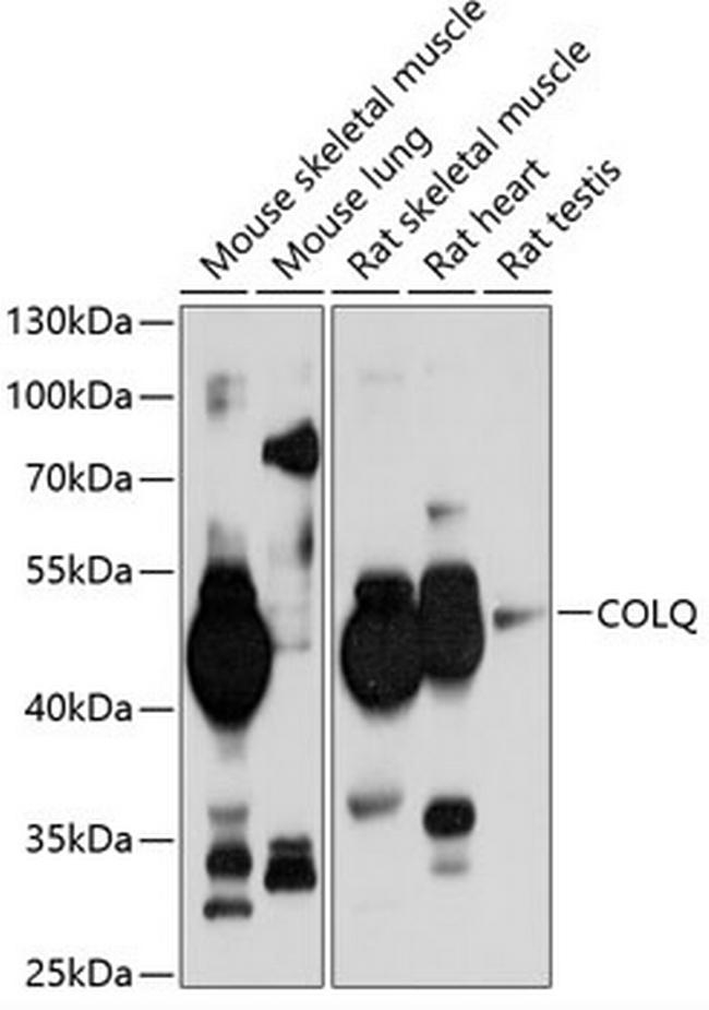 COLQ Antibody in Western Blot (WB)