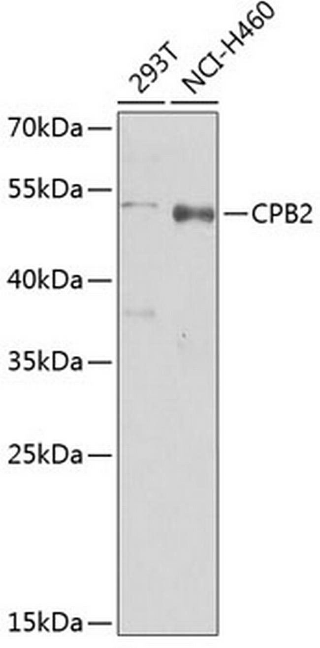 CPB2 Antibody in Western Blot (WB)