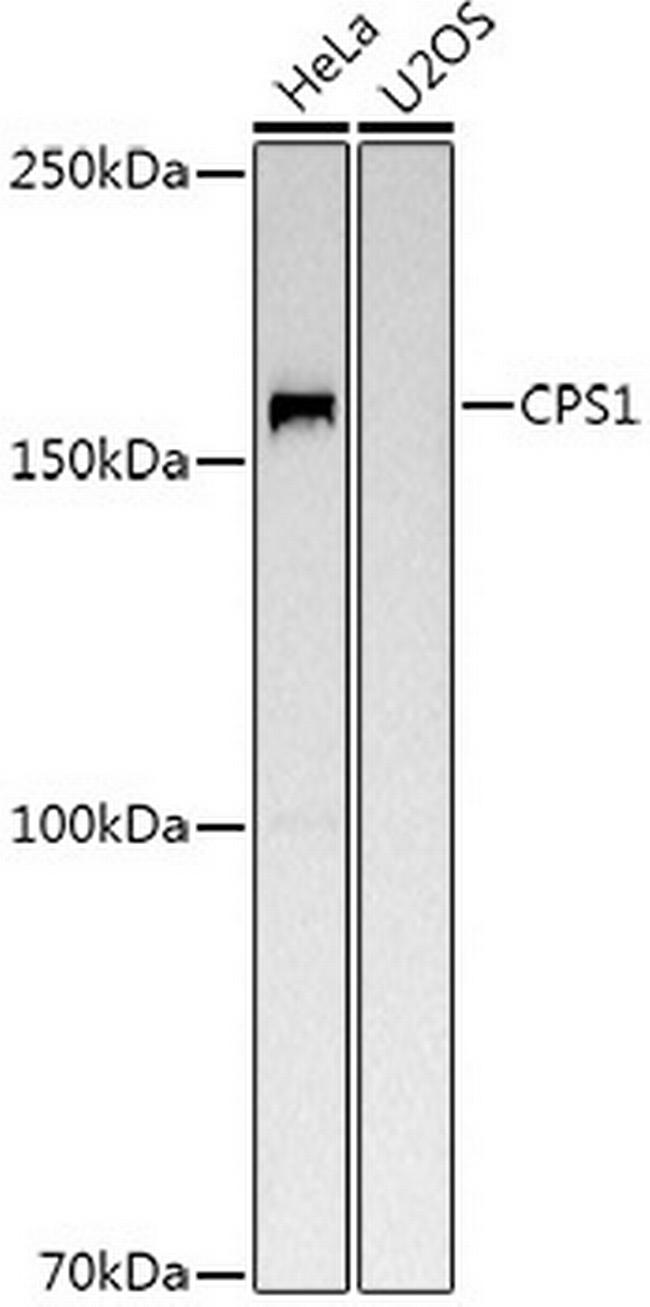 CPS1 Antibody in Western Blot (WB)