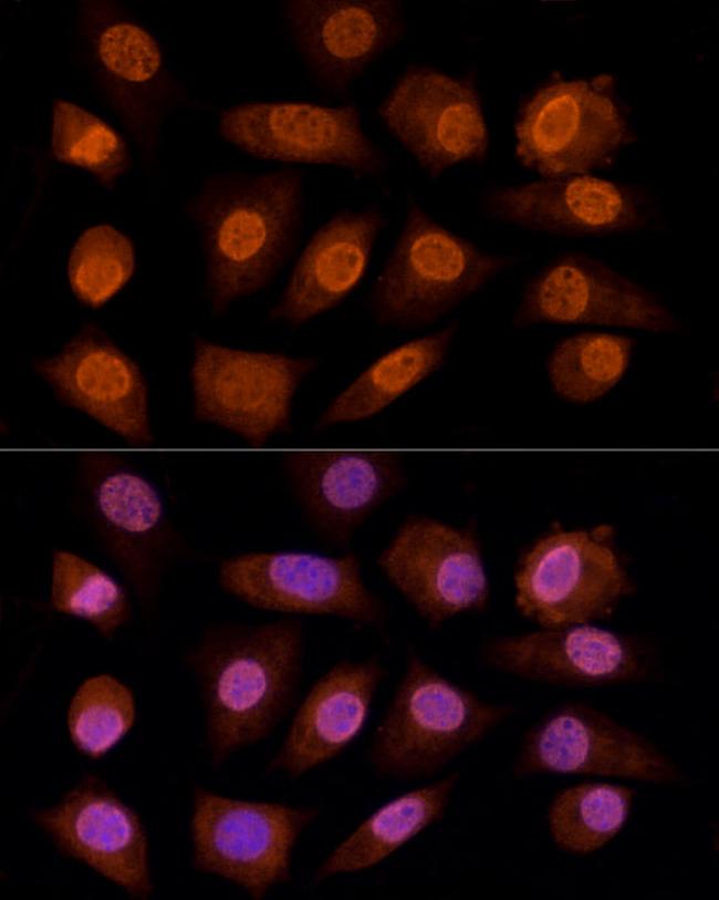 CRYGC Antibody in Immunocytochemistry (ICC/IF)