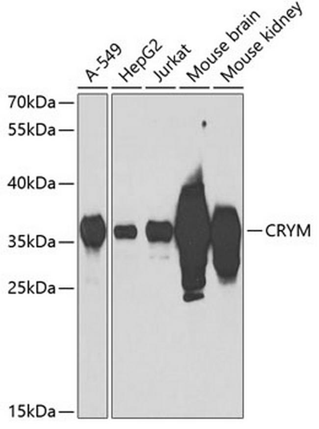 CRYM Antibody in Western Blot (WB)