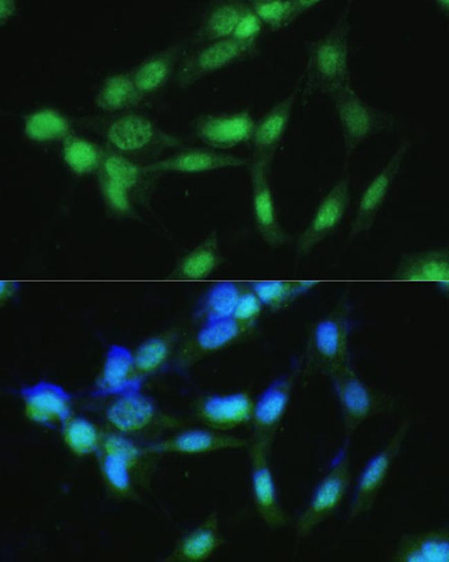 CSNK2A2 Antibody in Immunocytochemistry (ICC/IF)