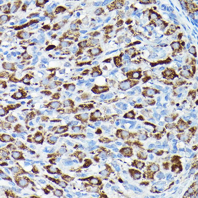 CYP11A1 Antibody in Immunohistochemistry (Paraffin) (IHC (P))