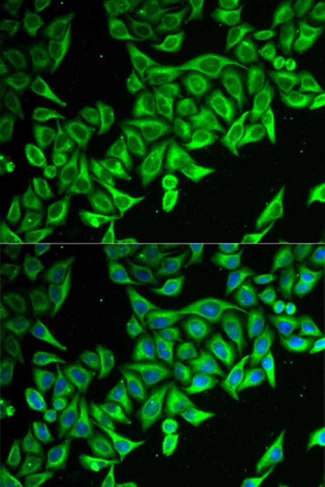 DAP Antibody in Immunocytochemistry (ICC/IF)