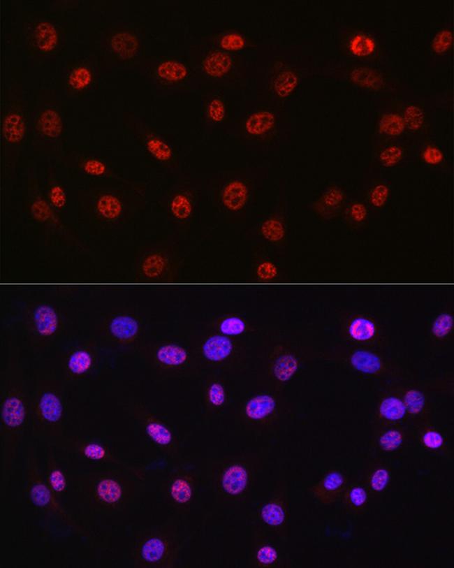 DDX39A Antibody in Immunocytochemistry (ICC/IF)