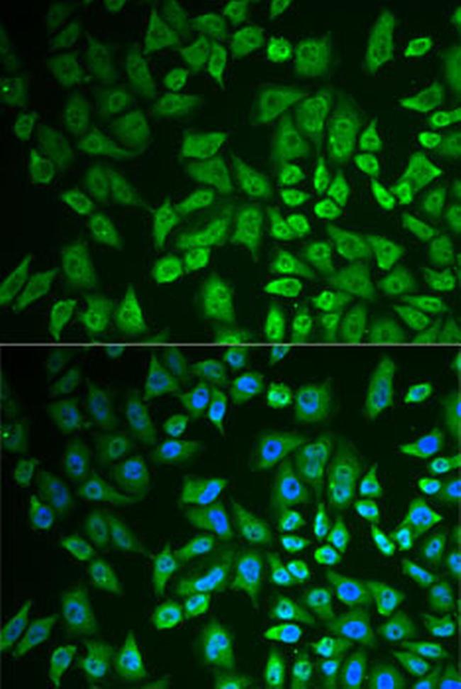 DDX41 Antibody in Immunocytochemistry (ICC/IF)