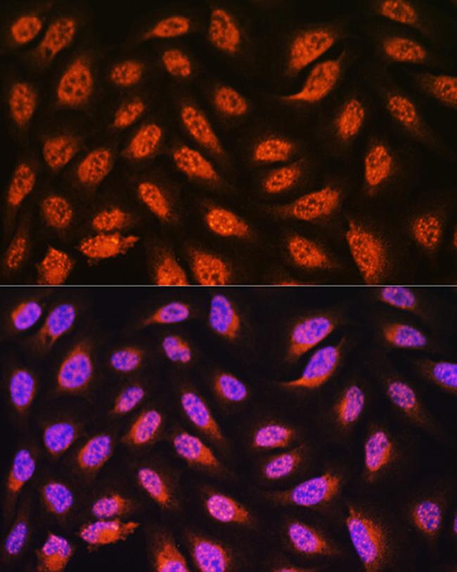 PNPO Antibody in Immunocytochemistry (ICC/IF)