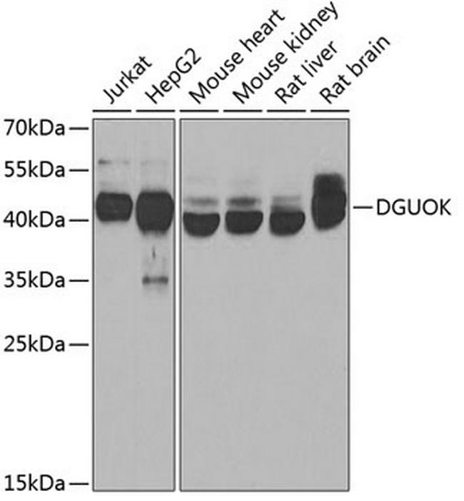 DGUOK Antibody in Western Blot (WB)