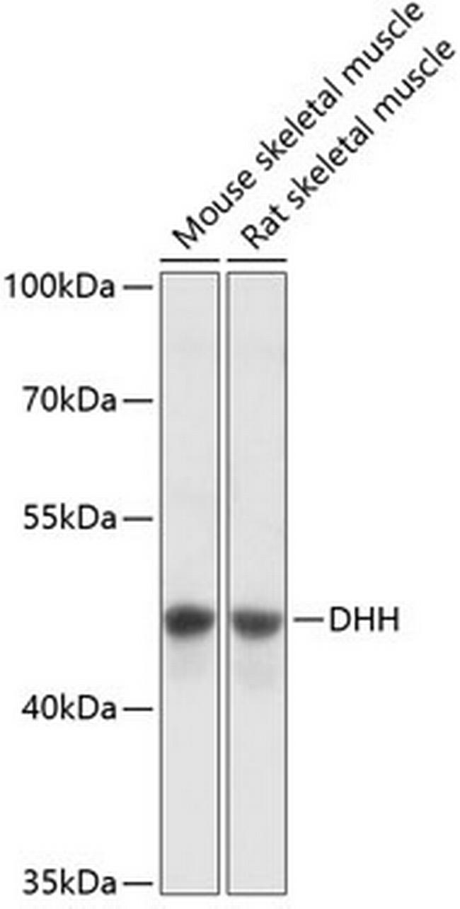 DHH Antibody in Western Blot (WB)