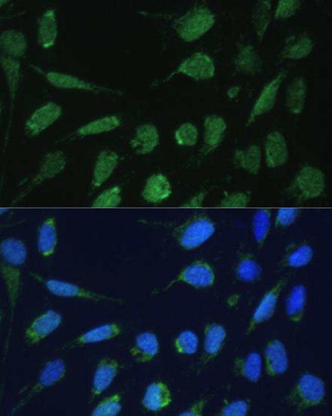 DLST Antibody in Immunocytochemistry (ICC/IF)