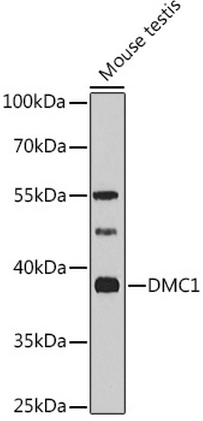 DMC1 Antibody in Western Blot (WB)