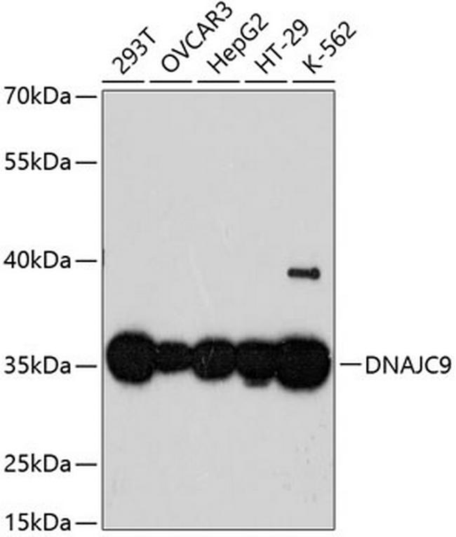 DNAJC9 Antibody in Western Blot (WB)