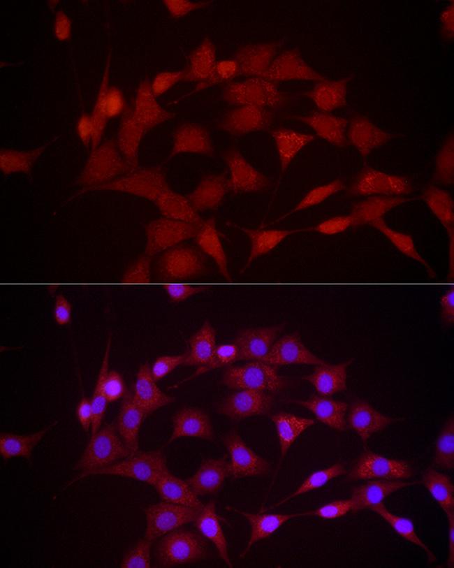 DUSP8 Antibody in Immunocytochemistry (ICC/IF)