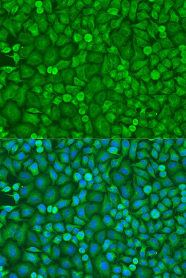 eIF4E Antibody in Immunocytochemistry (ICC/IF)