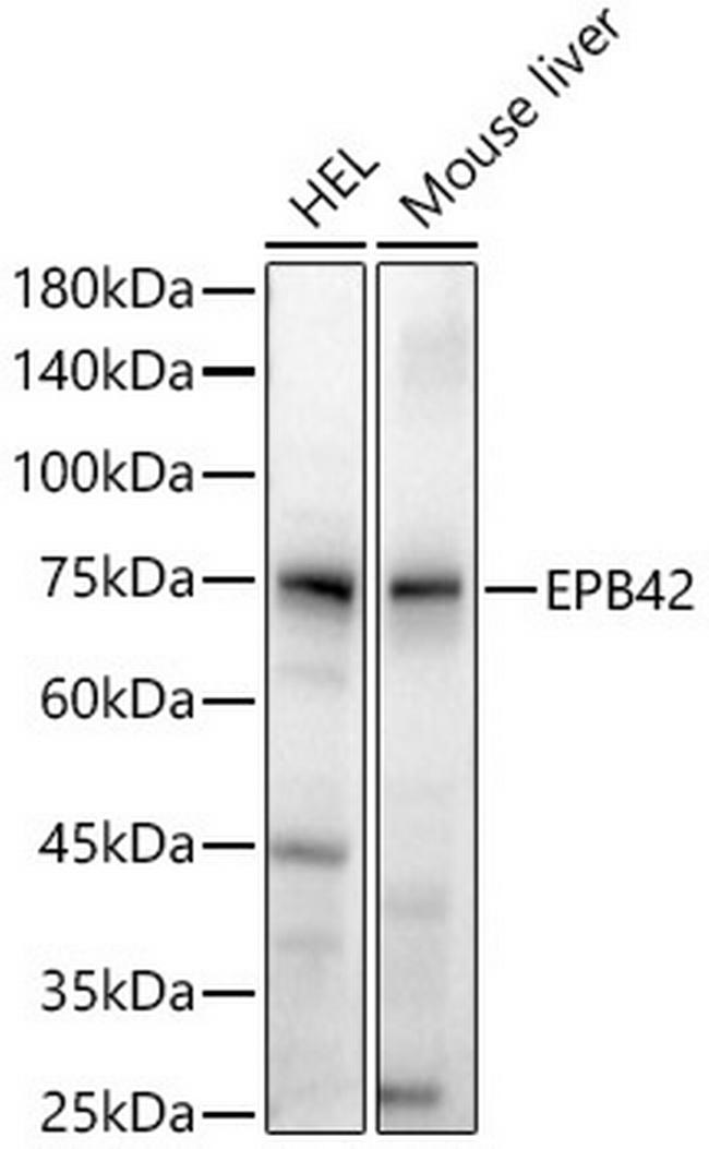 EPB42 Antibody in Western Blot (WB)