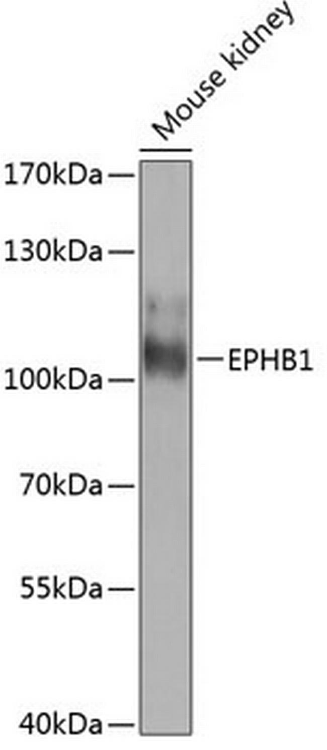 EphB1 Antibody in Western Blot (WB)