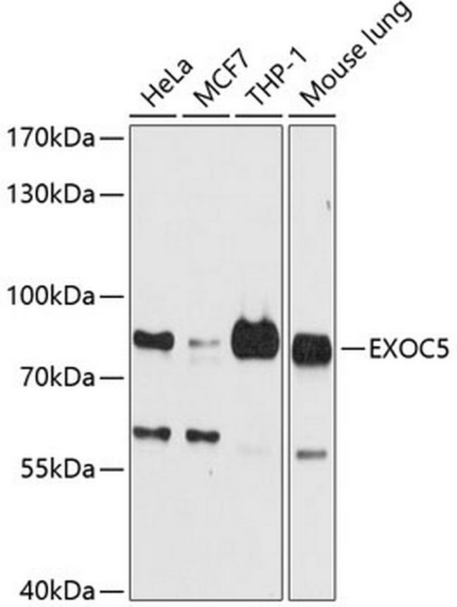 EXOC5 Antibody in Western Blot (WB)