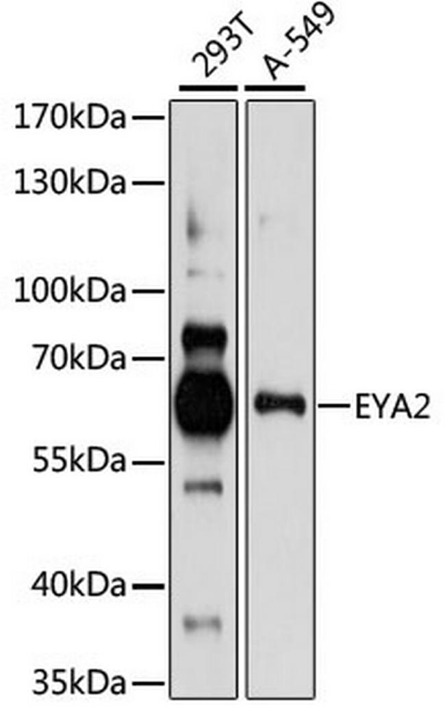 EYA2 Antibody in Western Blot (WB)