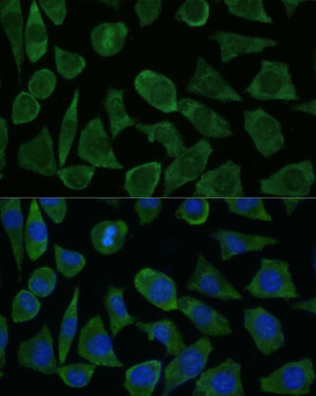 FKBP1B Antibody in Immunocytochemistry (ICC/IF)