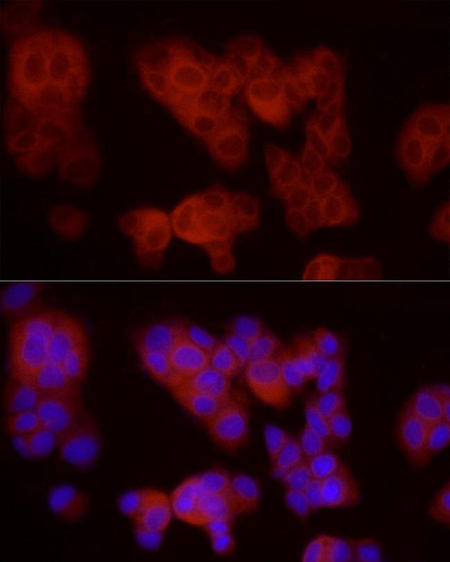 FLT4 Antibody in Immunocytochemistry (ICC/IF)