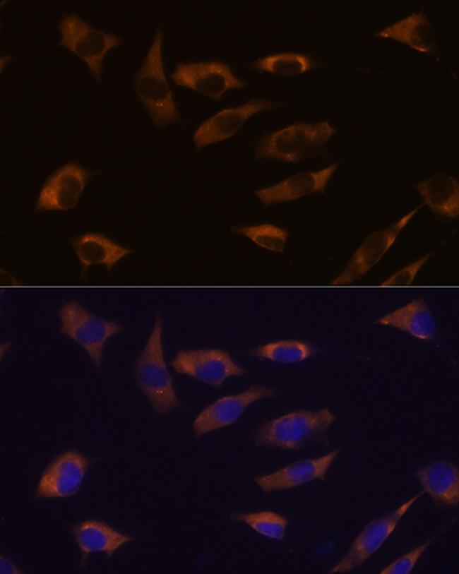 FSTL4 Antibody in Immunocytochemistry (ICC/IF)