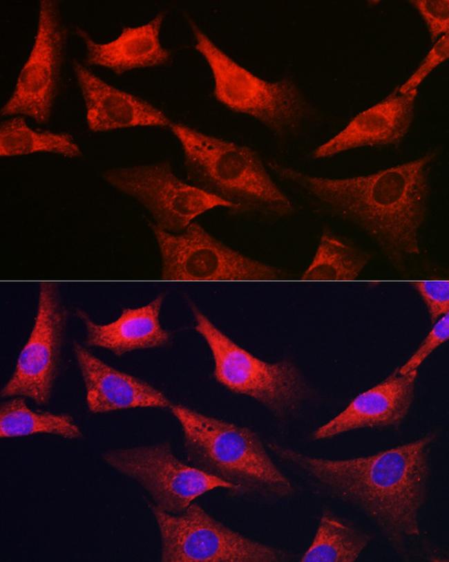 G6PC3 Antibody in Immunocytochemistry (ICC/IF)