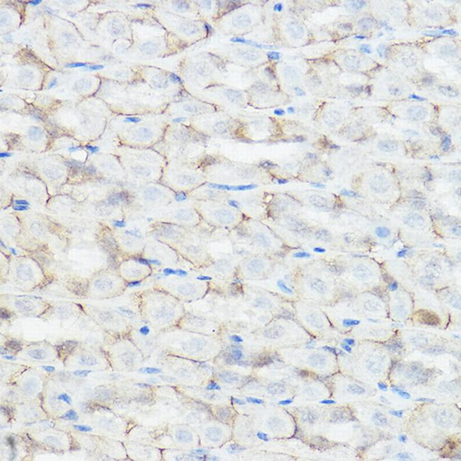 GABRA2 Antibody in Immunohistochemistry (Paraffin) (IHC (P))