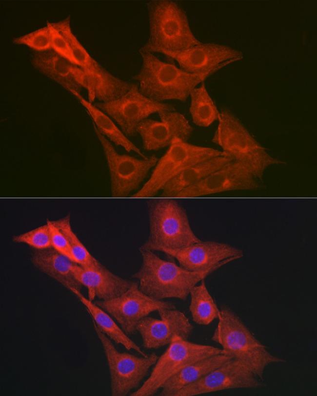 GART Antibody in Immunocytochemistry (ICC/IF)