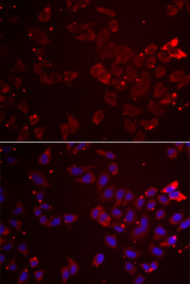 GATM Antibody in Immunocytochemistry (ICC/IF)