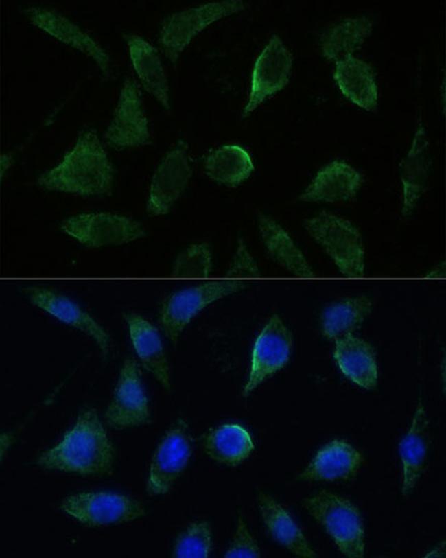 GK2 Antibody in Immunocytochemistry (ICC/IF)