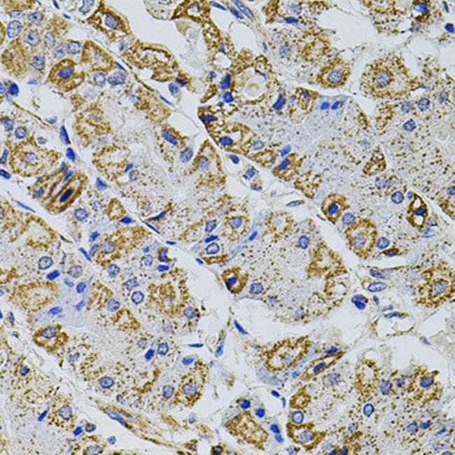 PRAMEF20 Antibody in Immunohistochemistry (Paraffin) (IHC (P))