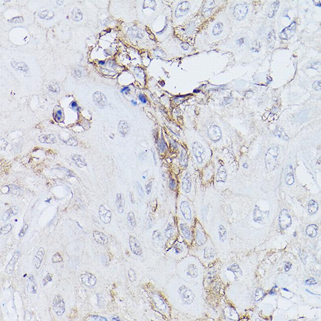 GNA11 Antibody in Immunohistochemistry (Paraffin) (IHC (P))