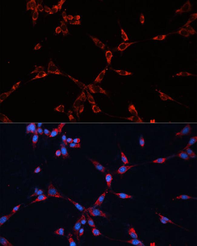 GNAI2 Antibody in Immunocytochemistry (ICC/IF)