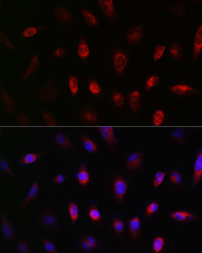 GNB3 Antibody in Immunocytochemistry (ICC/IF)