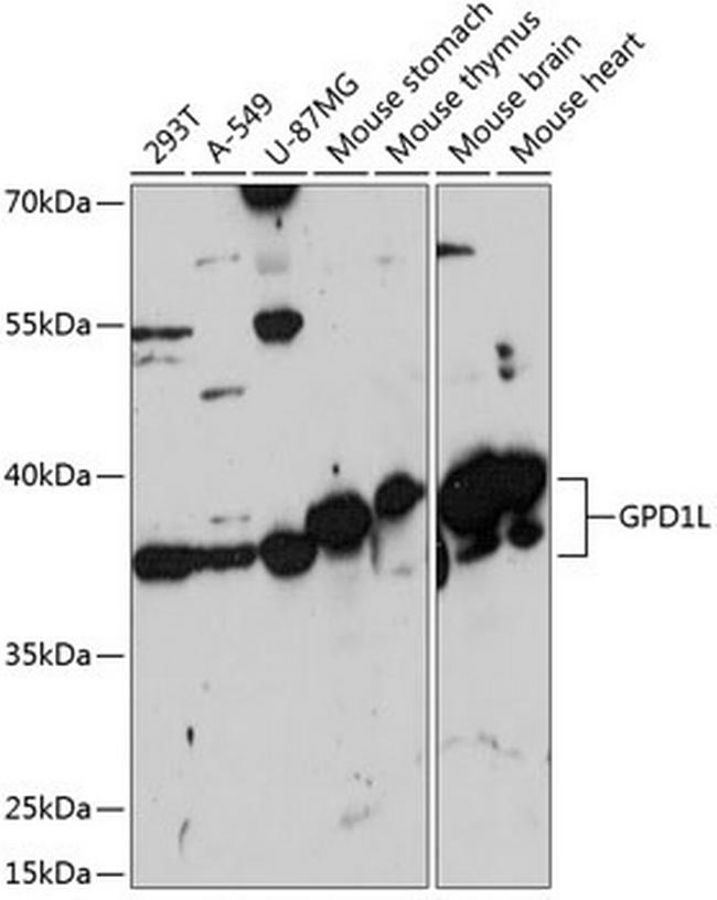 GPD1L Antibody in Western Blot (WB)