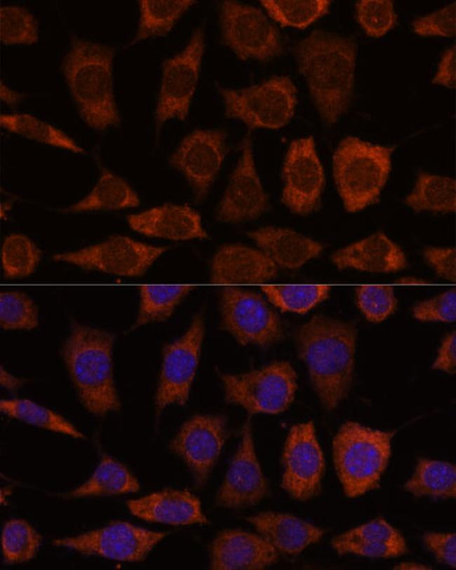 GRHPR Antibody in Immunocytochemistry (ICC/IF)