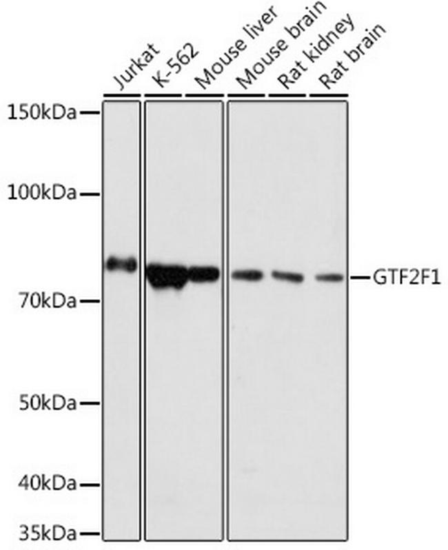 GTF2F1 Antibody in Western Blot (WB)