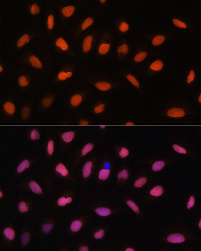 H2AFV Antibody in Immunocytochemistry (ICC/IF)