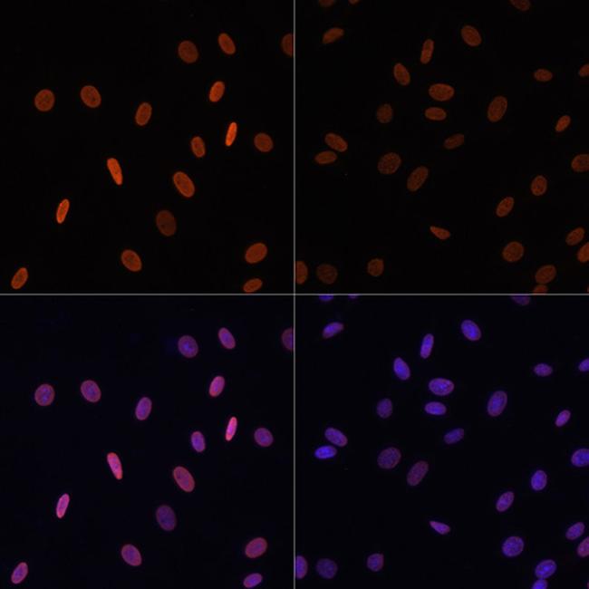 H2BK12ac Antibody in Immunocytochemistry (ICC/IF)