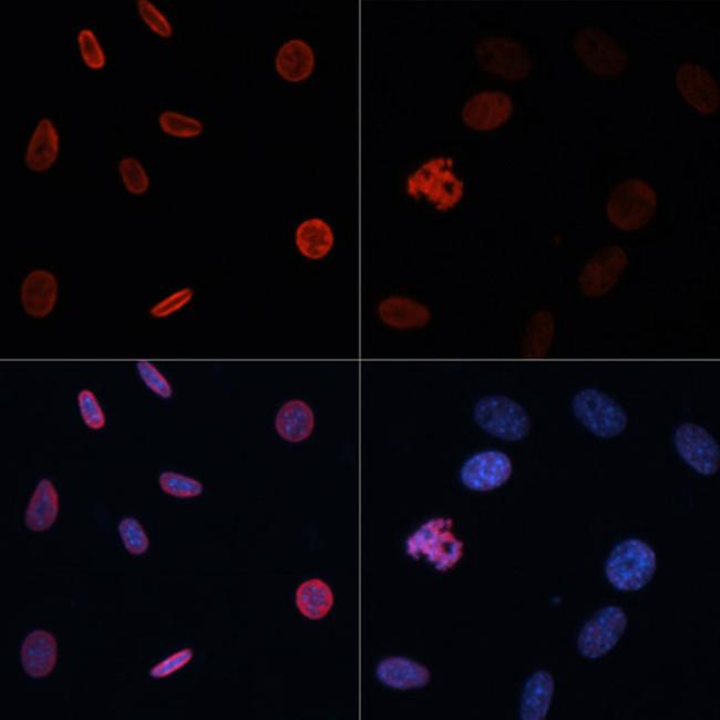 H2BK15ac Antibody in Immunocytochemistry (ICC/IF)