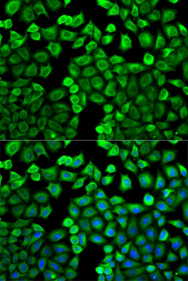 HNMT Antibody in Immunocytochemistry (ICC/IF)